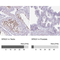 SPAG1 Antibody, Novus Biologicals 0.1mL; Unlabeled:Antibodies, Polyclonal